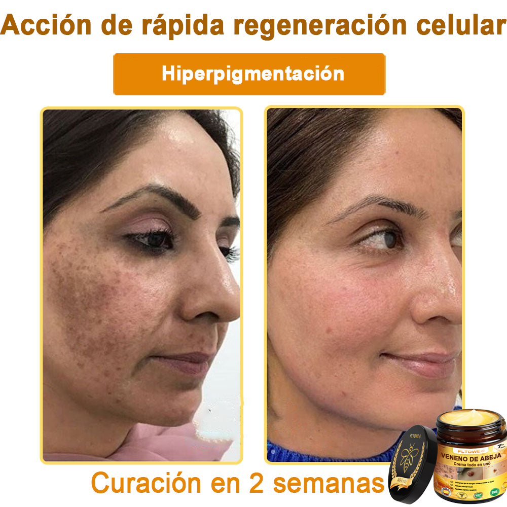 ¡ÚLTIMA OPORTUNIDAD! ¡Consigue este afortunado hallazgo con un 70 % de descuento! ¡GARANTÍA DE DEVOLUCIÓN DE DINERO DE 180 DÍAS!