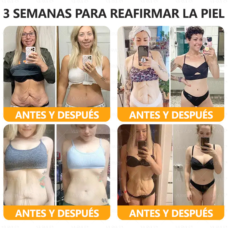 ✨ Crema Renovadora de Piel VLSVLS® con Veneno de Abeja 🔥 ÚLTIMO DÍA 80% DE DESCUENTO