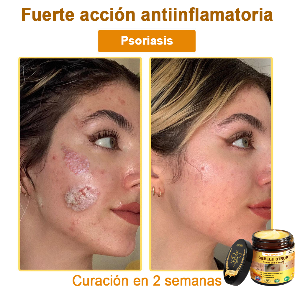 ¡ÚLTIMA OPORTUNIDAD! ¡Consigue este afortunado hallazgo con un 70 % de descuento! ¡GARANTÍA DE DEVOLUCIÓN DE DINERO DE 180 DÍAS!