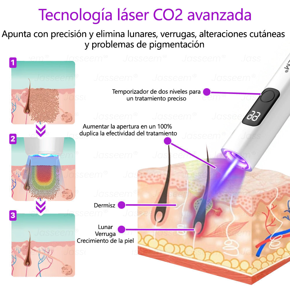 𝐉𝐚𝐬𝐬𝐞𝐞𝐦® Bolígrafo láser CO₂ avanzado y no invasivo para el cuidado de la piel 🛫 (Elimina suavemente verrugas, lunares, manchas de la edad y bultitos en la piel – ¡sin dolor y sin complicaciones!) 🛫