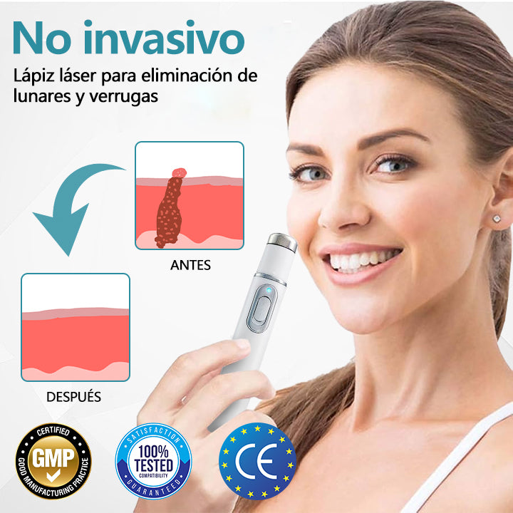 Bikenda® SpotAway Lápiz Láser Indoloro para Quitar Lunares✨