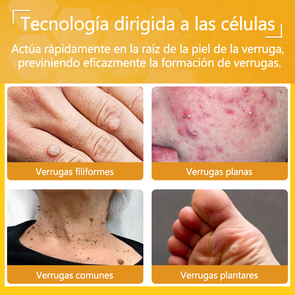 🐝Twinsun™ Súper Crema Potente con Veneno de Abeja, ¡aprobada por la EMA! 💖Perfecta para tratar verrugas, bultitos en la piel, infecciones, queratosis… ¡y para dejarte la piel suave y uniforme!