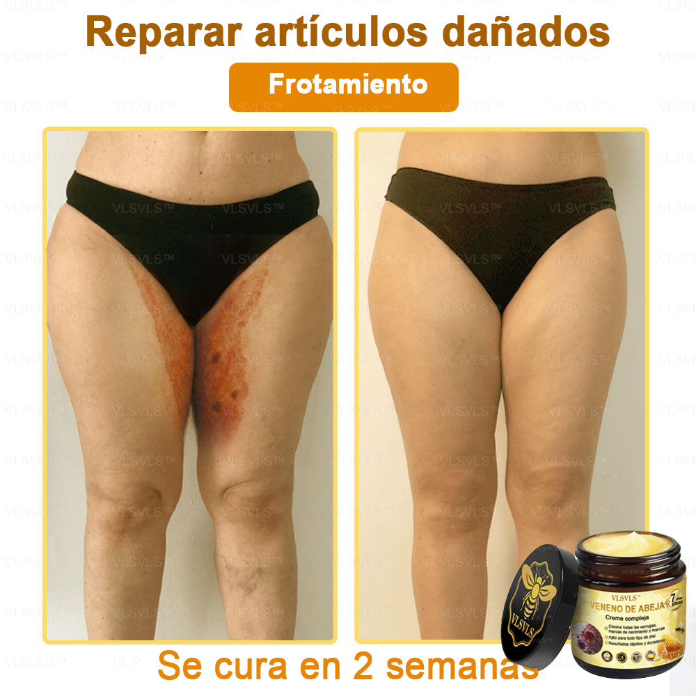 VLSVLS™ Crema con Veneno de Abeja de Efecto Completo 🧑⚕️ Recomendado por Dermatólogos - Para el Tratamiento de Diversos Problemas de la Piel🐝
