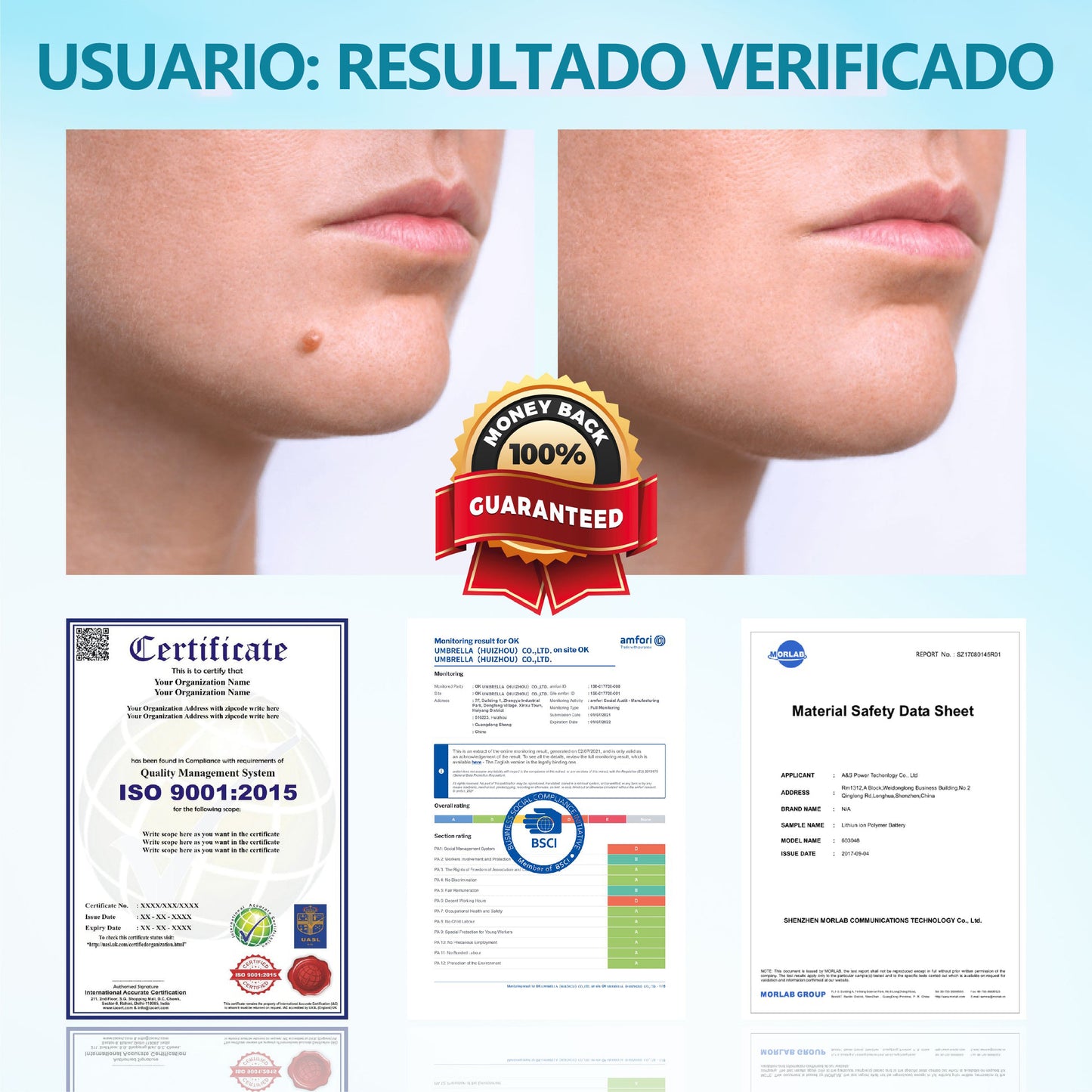 Bikenda® DermaLite Lápiz Láser Indoloro para Quitar Lunares🖊