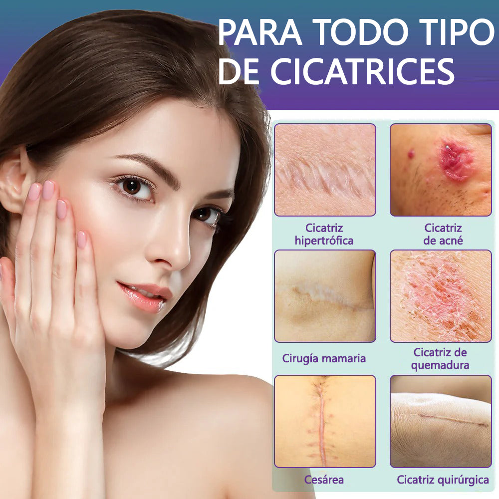 🏷️ Tienda Oficial: Flysmus® ReGen Cinta de Microneedles con Ácido Hialurónico Nano-Heal 💝 Tratamiento de cicatrices nuevas y antiguas, reducción de cicatrices quirúrgicas, estrías, queloides, acné, quemaduras, verrugas, dermatomas y venas varicosas 🌼