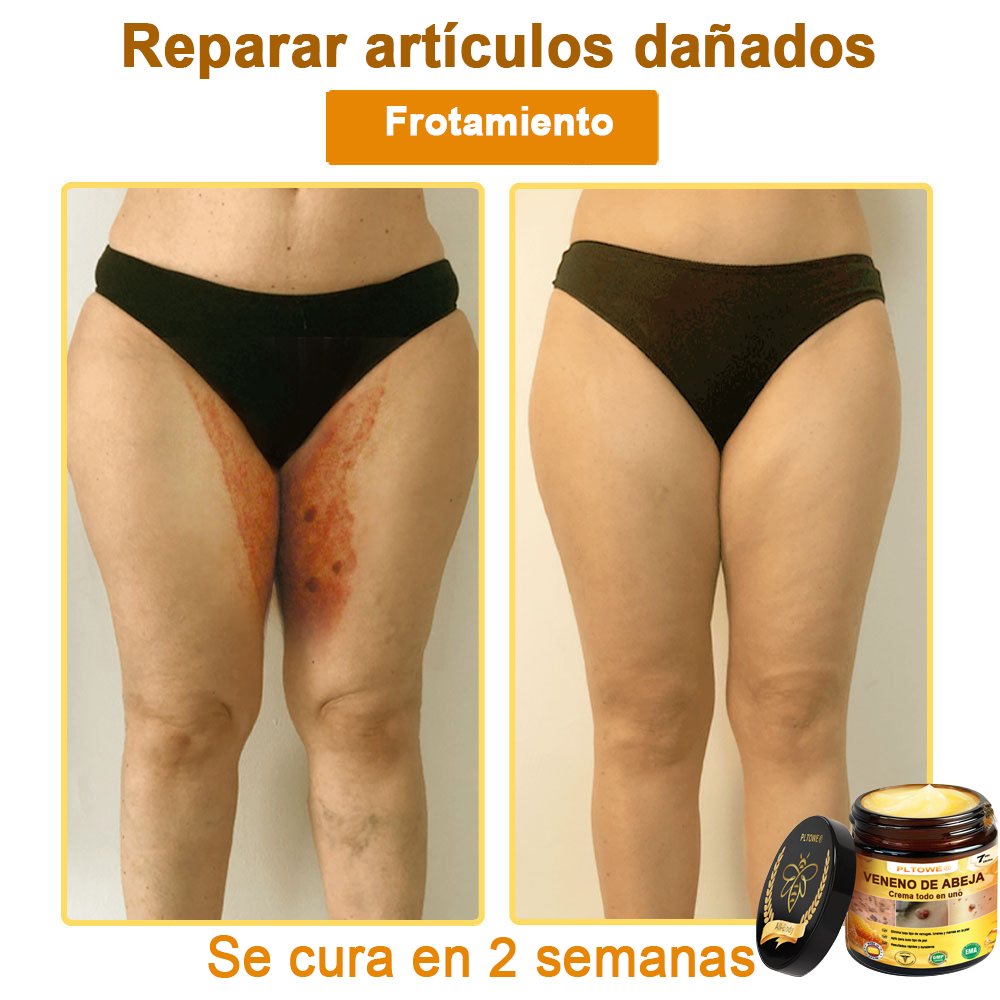 ¡ÚLTIMA OPORTUNIDAD! ¡Consigue este afortunado hallazgo con un 70 % de descuento! ¡GARANTÍA DE DEVOLUCIÓN DE DINERO DE 180 DÍAS!