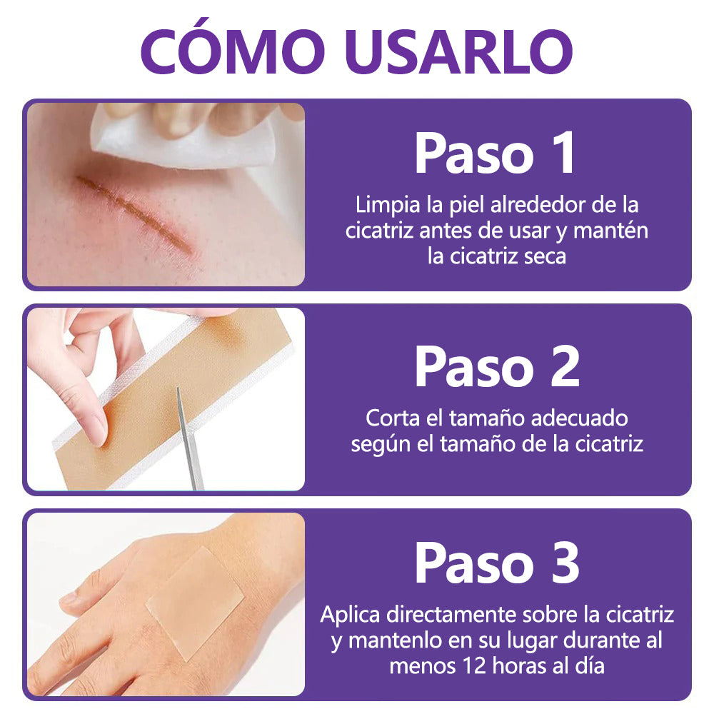 🏷️ Tienda Oficial: Flysmus® ReGen Cinta de Microneedles con Ácido Hialurónico Nano-Heal 💝 Tratamiento de cicatrices nuevas y antiguas, reducción de cicatrices quirúrgicas, estrías, queloides, acné, quemaduras, verrugas, dermatomas y venas varicosas 🌼