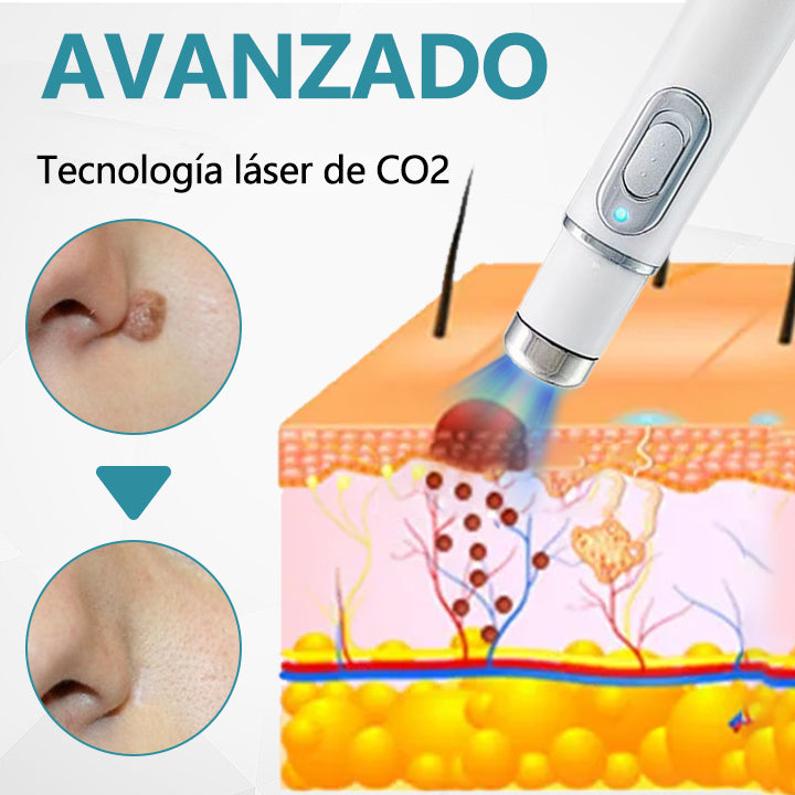 Bikenda® SpotAway Lápiz Láser Indoloro para Quitar Lunares✨