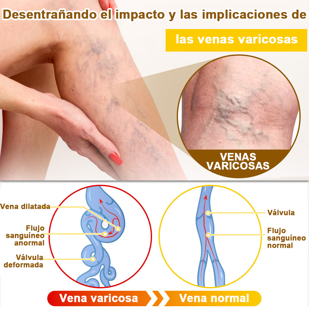 Crema cicatrizante ✅flysmus™ con veneno de abeja🐝: Tratamiento de eczemas, psoriasis, acné, rosácea, infecciones fúngicas y verrugas