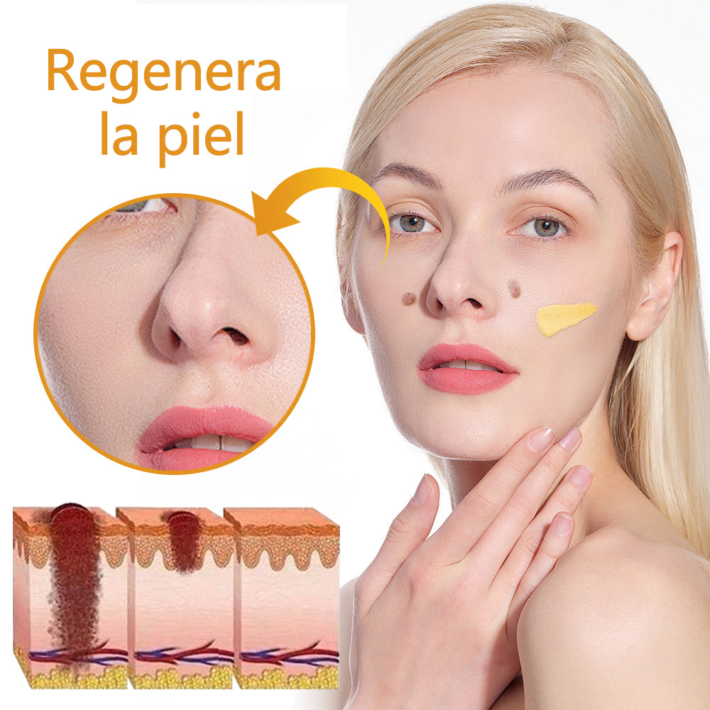 🐝Twinsun™ Súper Crema Potente con Veneno de Abeja, ¡aprobada por la EMA! 💖Perfecta para tratar verrugas, bultitos en la piel, infecciones, queratosis… ¡y para dejarte la piel suave y uniforme!