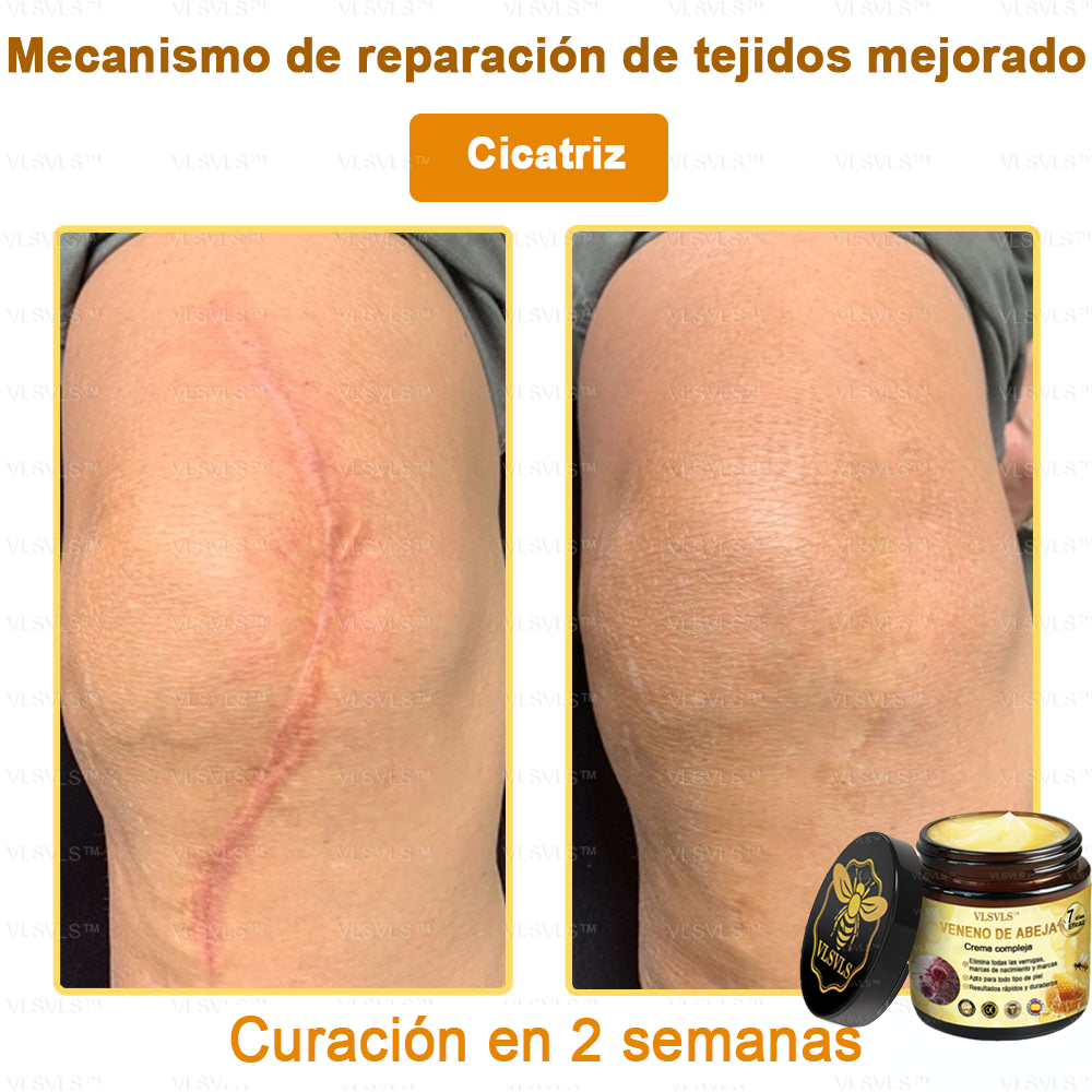 VLSVLS™ Crema con Veneno de Abeja de Efecto Completo 🧑‍⚕️ Recomendado por Dermatólogos - Para el Tratamiento de Diversos Problemas de la Piel🐝