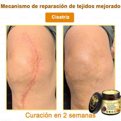 VLSVLS™ Crema con Veneno de Abeja de Efecto Completo 🧑‍⚕️ Recomendado por Dermatólogos - Para el Tratamiento de Diversos Problemas de la Piel🐝