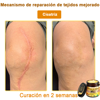 ¡ÚLTIMA OPORTUNIDAD! ¡Consigue este afortunado hallazgo con un 70 % de descuento! ¡GARANTÍA DE DEVOLUCIÓN DE DINERO DE 180 DÍAS!