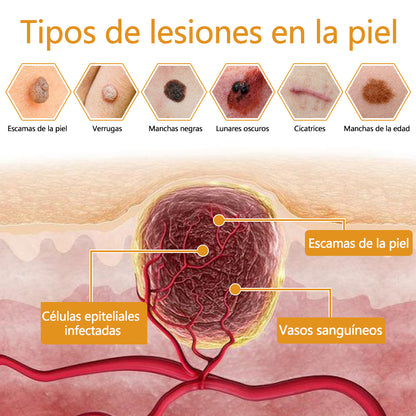 🐝Twinsun™ Súper Crema Potente con Veneno de Abeja, ¡aprobada por la EMA! 💖Perfecta para tratar verrugas, bultitos en la piel, infecciones, queratosis… ¡y para dejarte la piel suave y uniforme!