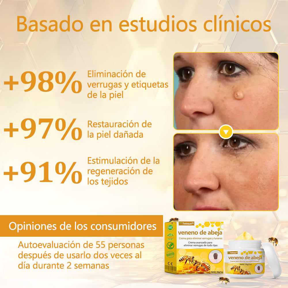 🐝Twinsun™ Súper Crema Potente con Veneno de Abeja, ¡aprobada por la EMA! 💖Perfecta para tratar verrugas, bultitos en la piel, infecciones, queratosis… ¡y para dejarte la piel suave y uniforme!