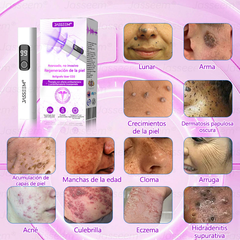 𝐉𝐚𝐬𝐬𝐞𝐞𝐦® Bolígrafo láser CO₂ avanzado y no invasivo para el cuidado de la piel (Elimina suavemente verrugas, lunares, manchas de la edad y bultitos en la piel – ¡sin dolor y sin complicaciones!)🛫