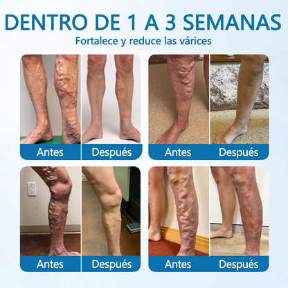 💚 Trimil® VeinGuard spray de hierbas – ✅ ¡Clínicamente probado para reducir las varices en solo 7 días! (avalado por la Agencia Europea de Medicamentos – EMA)🌿