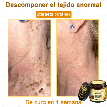VLSVLS™ Crema con Veneno de Abeja de Efecto Completo 🧑‍⚕️ Recomendado por Dermatólogos - Para el Tratamiento de Diversos Problemas de la Piel🐝