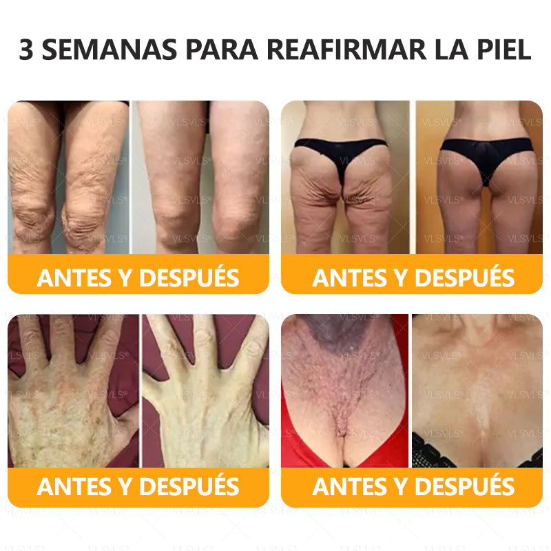 ✨ VLSVLS® Crema Renovadora con Veneno de Abeja – ¡ÚLTIMO DÍA con 80% de DESCUENTO! 🔥