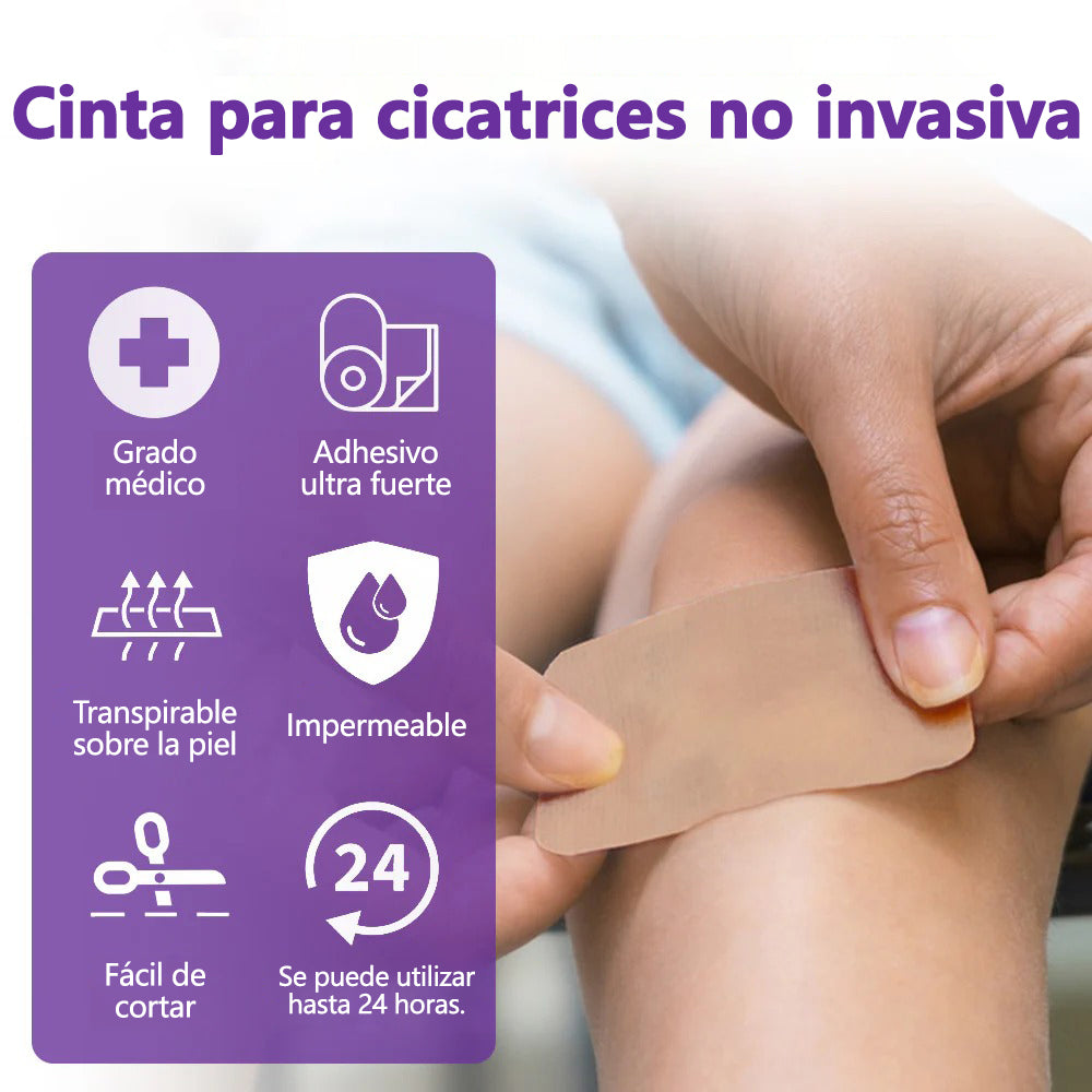 🏷️ Tienda Oficial: Flysmus® ReGen Cinta de Microneedles con Ácido Hialurónico Nano-Heal 💝 Tratamiento de cicatrices nuevas y antiguas, reducción de cicatrices quirúrgicas, estrías, queloides, acné, quemaduras, verrugas, dermatomas y venas varicosas