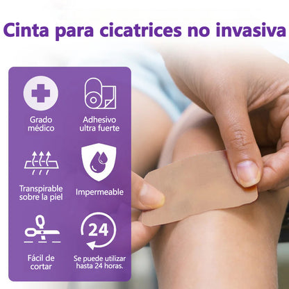 🏷️ Tienda Oficial: Flysmus® ReGen Cinta de Microneedles con Ácido Hialurónico Nano-Heal 💝 Tratamiento de cicatrices nuevas y antiguas, reducción de cicatrices quirúrgicas, estrías, queloides, acné, quemaduras, verrugas, dermatomas y venas varicosas
