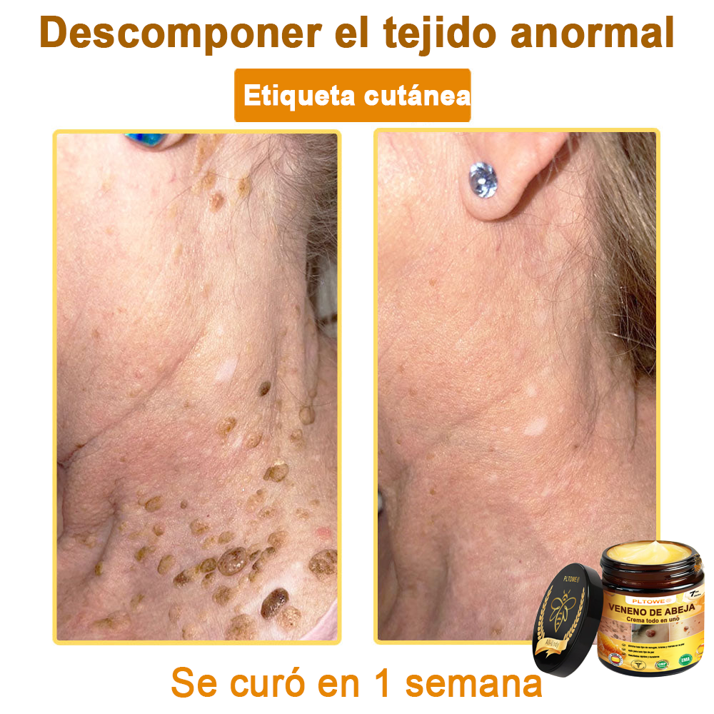 ¡ÚLTIMA OPORTUNIDAD! ¡Consigue este afortunado hallazgo con un 70 % de descuento! ¡GARANTÍA DE DEVOLUCIÓN DE DINERO DE 180 DÍAS!