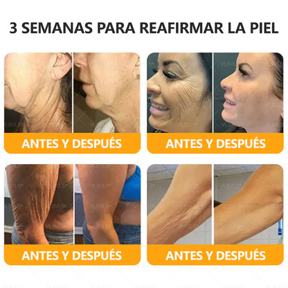 ✨ VLSVLS® Crema Renovadora con Veneno de Abeja – ¡ÚLTIMO DÍA con 80% de DESCUENTO! 🔥