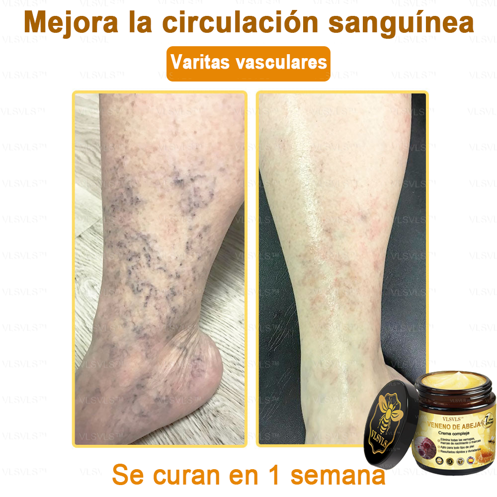 VLSVLS™ Crema con Veneno de Abeja de Efecto Completo 🧑‍⚕️ Recomendado por Dermatólogos - Para el Tratamiento de Diversos Problemas de la Piel🐝