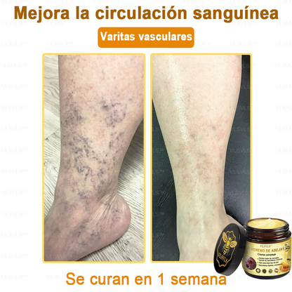 VLSVLS™ Crema con Veneno de Abeja de Efecto Completo 🧑‍⚕️ Recomendado por Dermatólogos - Para el Tratamiento de Diversos Problemas de la Piel🐝