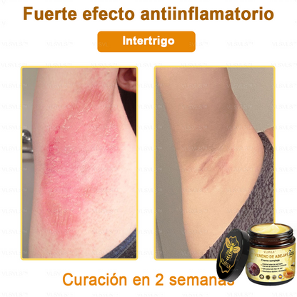 VLSVLS™ Crema con Veneno de Abeja de Efecto Completo 🧑‍⚕️ Recomendado por Dermatólogos - Para el Tratamiento de Diversos Problemas de la Piel🐝