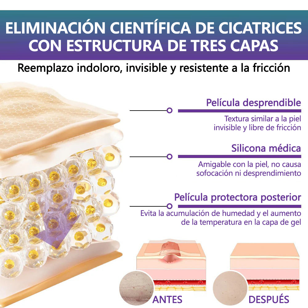 🏷️ Tienda Oficial: Flysmus® ReGen Cinta de Microneedles con Ácido Hialurónico Nano-Heal 💝 Tratamiento de cicatrices nuevas y antiguas, reducción de cicatrices quirúrgicas, estrías, queloides, acné, quemaduras, verrugas, dermatomas y venas varicosas