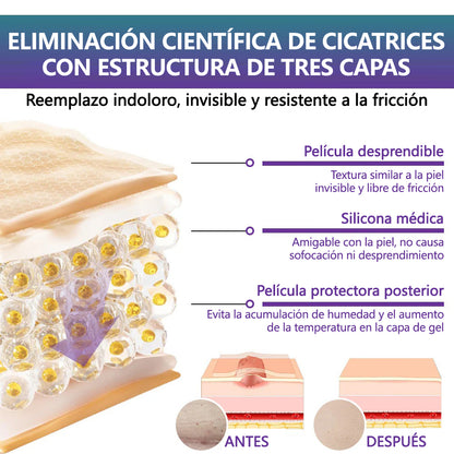 🏷️ Tienda Oficial: Flysmus® ReGen Cinta de Microneedles con Ácido Hialurónico Nano-Heal 💝 Tratamiento de cicatrices nuevas y antiguas, reducción de cicatrices quirúrgicas, estrías, queloides, acné, quemaduras, verrugas, dermatomas y venas varicosas