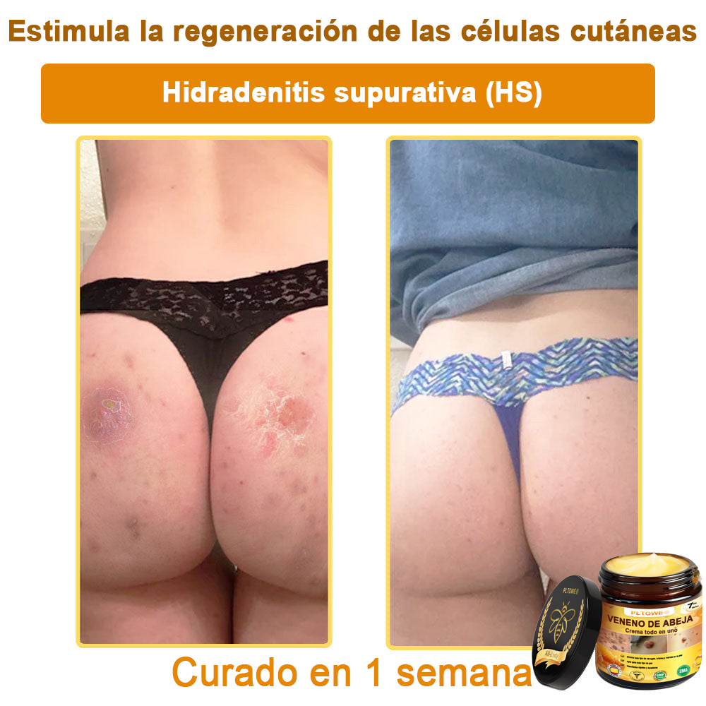 ¡ÚLTIMA OPORTUNIDAD! ¡Consigue este afortunado hallazgo con un 70 % de descuento! ¡GARANTÍA DE DEVOLUCIÓN DE DINERO DE 180 DÍAS!