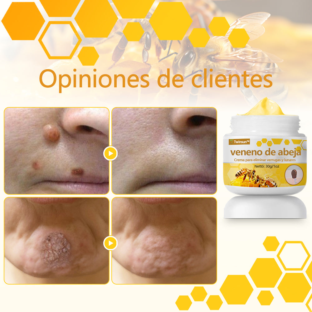 🐝Twinsun™ Súper Crema Potente con Veneno de Abeja, ¡aprobada por la EMA! 💖Perfecta para tratar verrugas, bultitos en la piel, infecciones, queratosis… ¡y para dejarte la piel suave y uniforme!