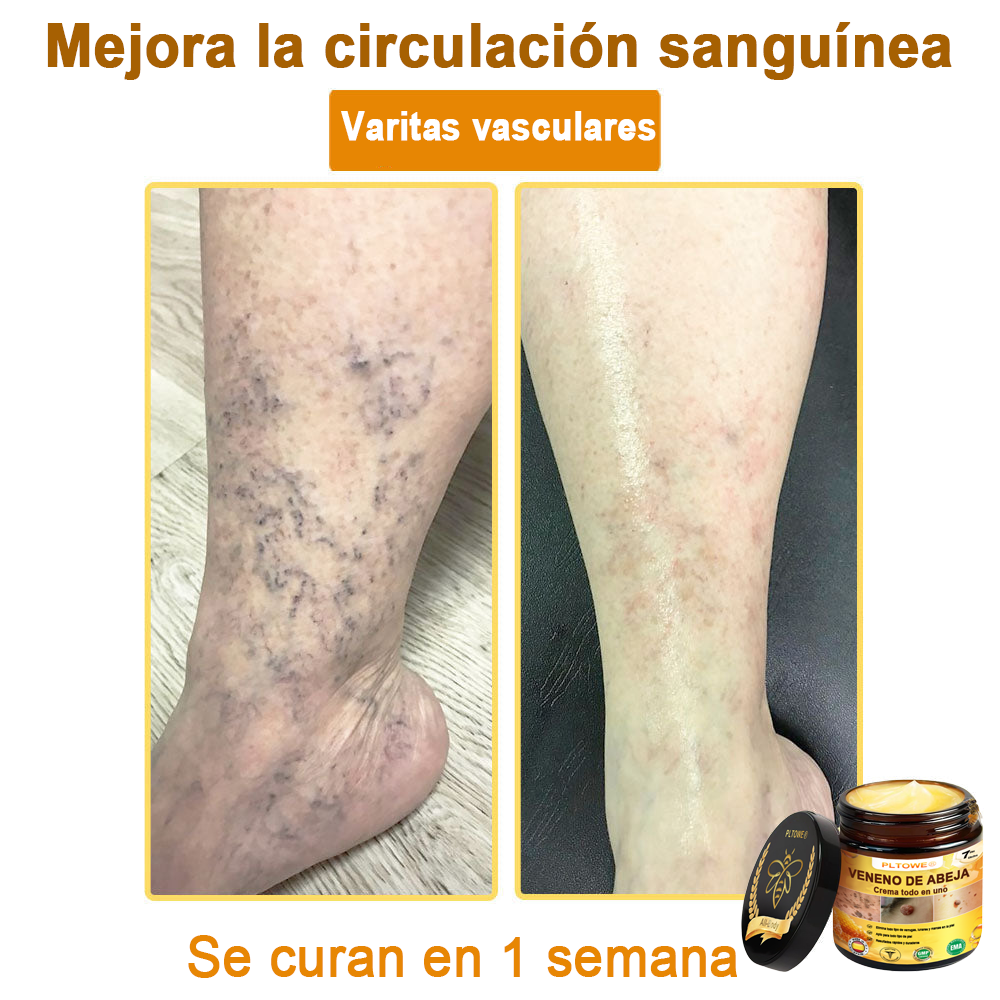 ¡ÚLTIMA OPORTUNIDAD! ¡Consigue este afortunado hallazgo con un 70 % de descuento! ¡GARANTÍA DE DEVOLUCIÓN DE DINERO DE 180 DÍAS!