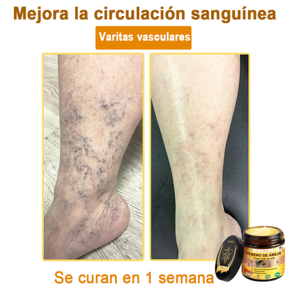 ¡ÚLTIMA OPORTUNIDAD! ¡Consigue este afortunado hallazgo con un 70 % de descuento! ¡GARANTÍA DE DEVOLUCIÓN DE DINERO DE 180 DÍAS!