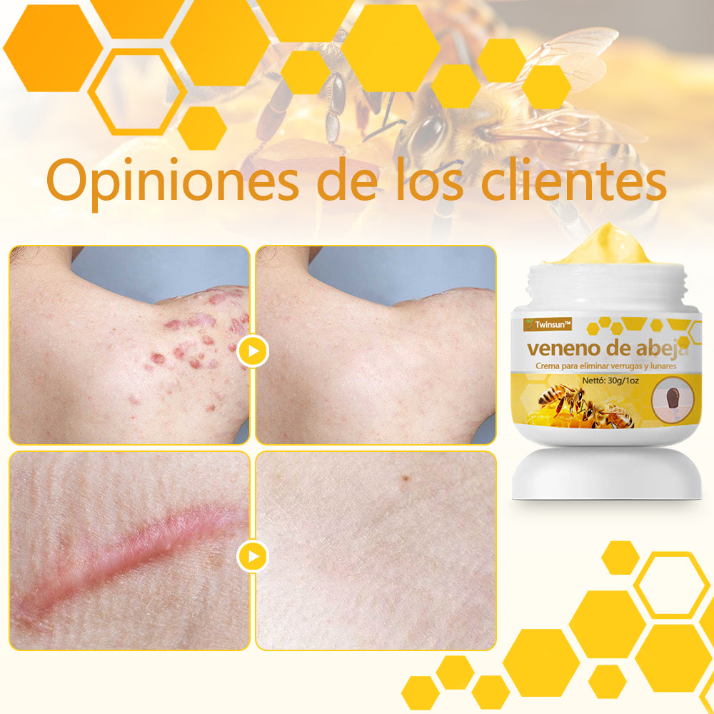 🐝Twinsun™ Súper Crema Potente con Veneno de Abeja, ¡aprobada por la EMA! 💖Perfecta para tratar verrugas, bultitos en la piel, infecciones, queratosis… ¡y para dejarte la piel suave y uniforme!