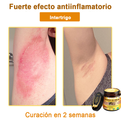¡ÚLTIMA OPORTUNIDAD! ¡Consigue este afortunado hallazgo con un 70 % de descuento! ¡GARANTÍA DE DEVOLUCIÓN DE DINERO DE 180 DÍAS!