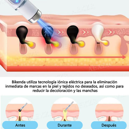 Bikenda® lápiz láser no invasivo para eliminar manchas y verrugas