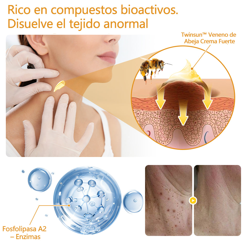 🐝Twinsun™ Súper Crema Potente con Veneno de Abeja, ¡aprobada por la EMA! 💖Perfecta para tratar verrugas, bultitos en la piel, infecciones, queratosis… ¡y para dejarte la piel suave y uniforme!