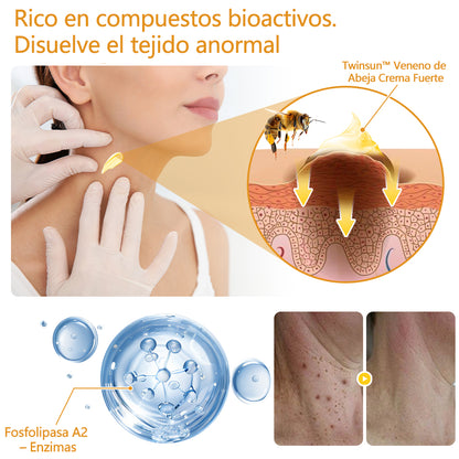 🐝Twinsun™ Súper Crema Potente con Veneno de Abeja, ¡aprobada por la EMA! 💖Perfecta para tratar verrugas, bultitos en la piel, infecciones, queratosis… ¡y para dejarte la piel suave y uniforme!