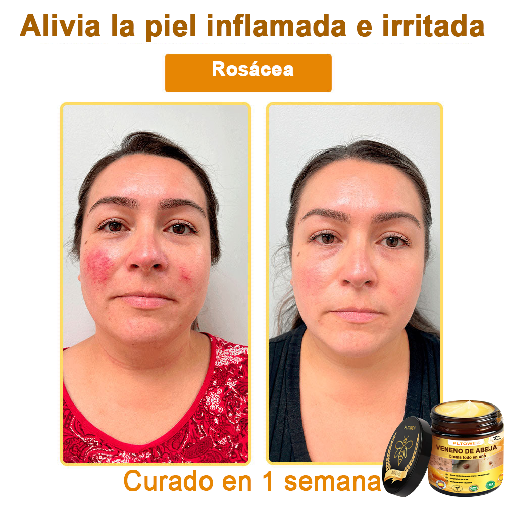 ¡ÚLTIMA OPORTUNIDAD! ¡Consigue este afortunado hallazgo con un 70 % de descuento! ¡GARANTÍA DE DEVOLUCIÓN DE DINERO DE 180 DÍAS!